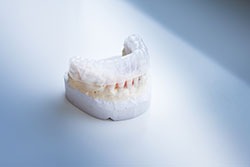 Cosmetic-Dentistry---Invisalign-by-Cosmetic-Dental-of-Encino-(3)