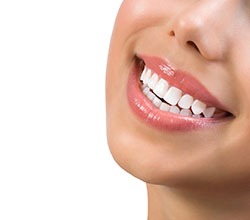 Cosmetic-Dentistry---Teeth-Whitening-by-Cosmetic-Dental-of-Encino--(1)