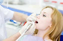 General-Dentistry---Cleanings-&-Exams-by-Cosmetic-Dental-of-Encino-(4)