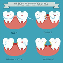 General-Dentistry-Gum-Disease-Cleanings-by-Cosmetic-Dental-of-Encino-2
