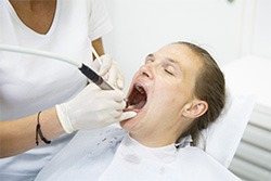 General-Dentistry-Gum-Disease-Cleanings-by-Cosmetic-Dental-of-Encino-3