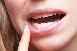 General-Dentistry-Oral-Cancer-Screening-by-Cosmetic-Dental-of-Encino-2