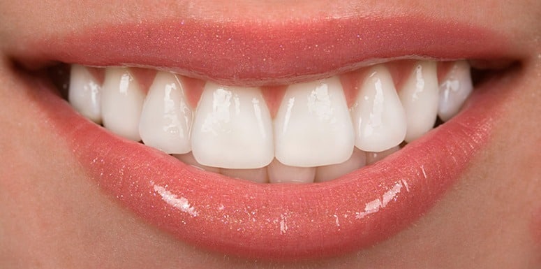 encino-dentist-explains-the-benefits-of-veneers