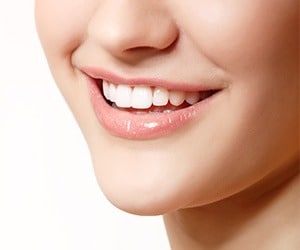 Cosmetic-Dentistry-Bridges-by-Cosmetic-Dental-of-Encino