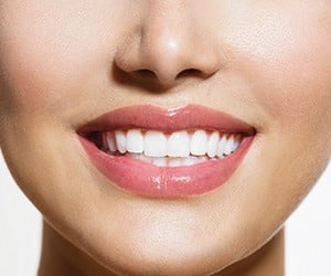 Cosmetic-Dentistry-Teeth-Whitening-by-Cosmetic-Dental-of-Encino-tn