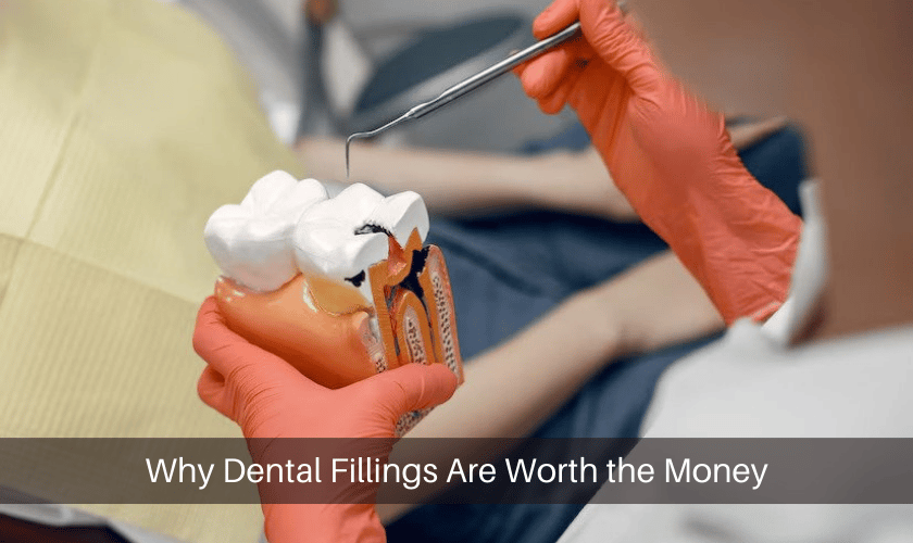 Why Dental Fillings Are Worth the Money