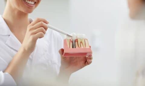 Dental Implants In Signature Smiles of Encino CA, dental implants demo