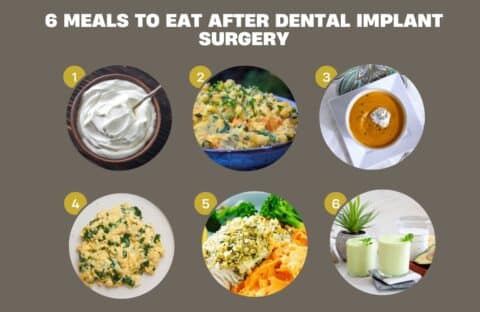 6 Meals to Eat After Dental Implant Surgery - Dental Implant Encino