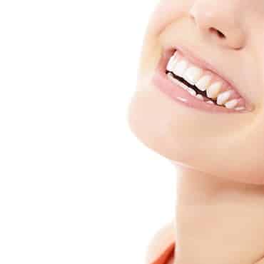 Dental Invisalign - Dentist Encino